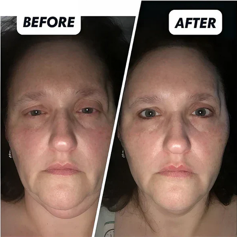 Anti-Aging Retinol Moisturizer