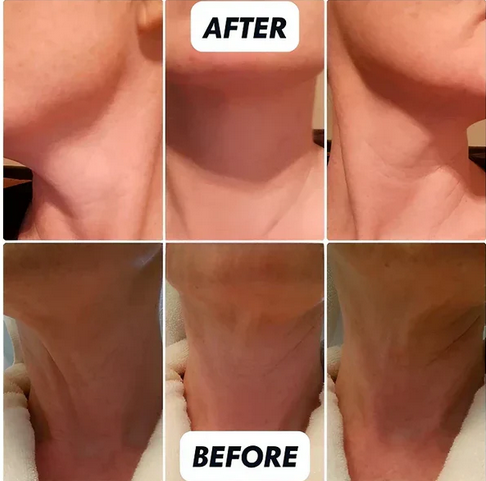 Anti-Aging Retinol Moisturizer