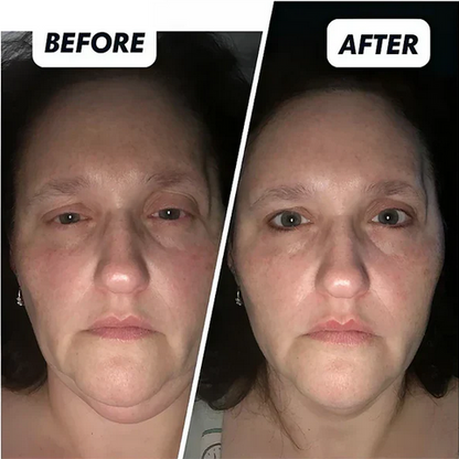 Anti-Aging Retinol Moisturizer